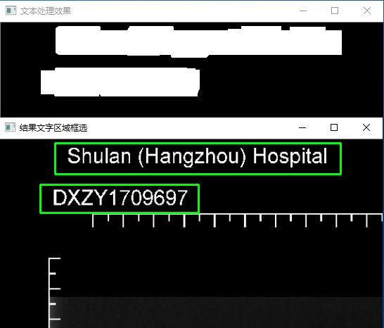 .NET csharp医疗胶片患者识别号文字区域检测例子