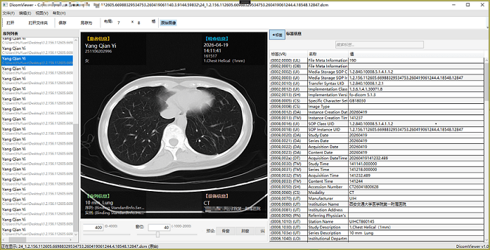 DicomViewer - 轻量级 DICOM 影像查看器源码